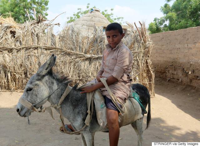 YEMEN-CONFLICT-MALNUTRITION
