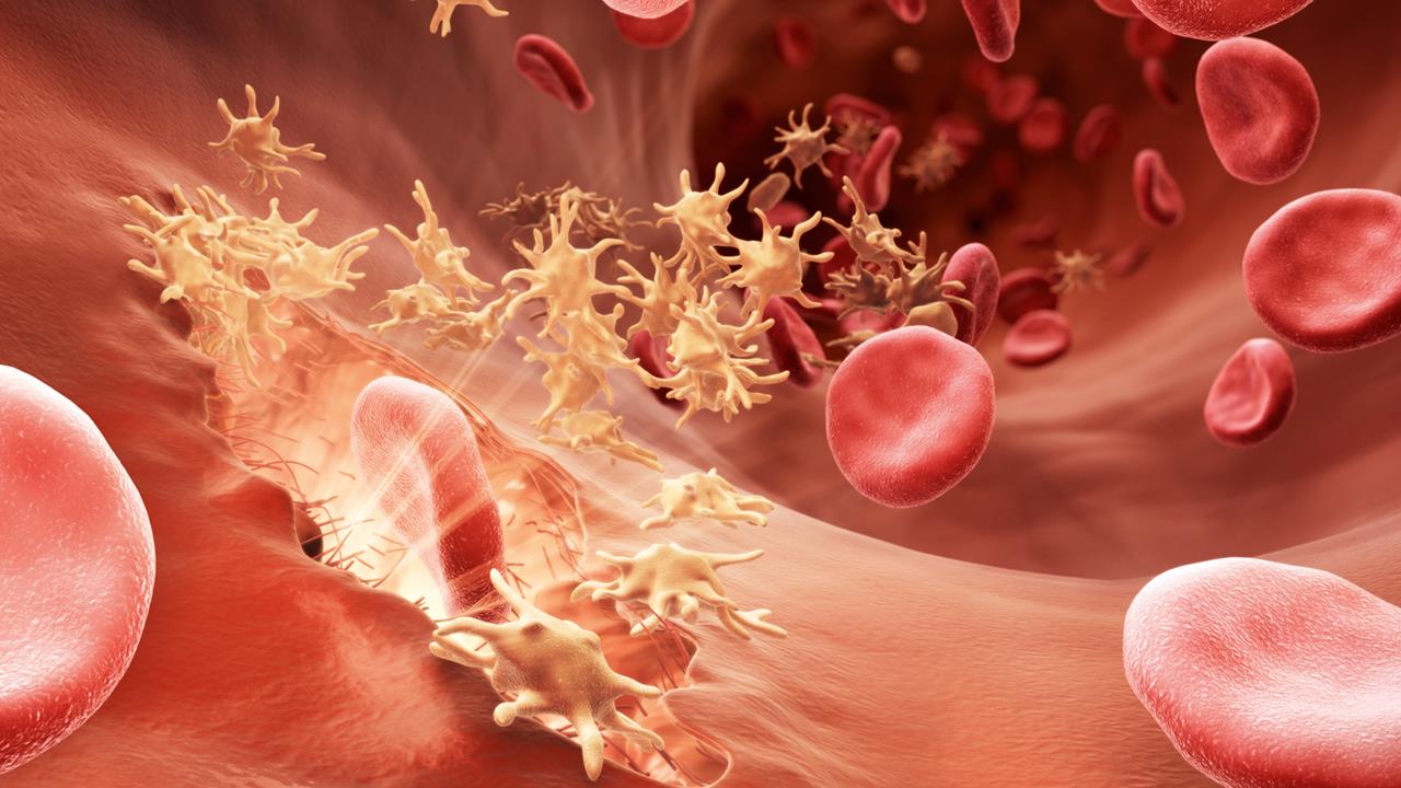 hemophilia